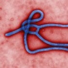 Ebola virus: diagnose, symptomen, behandeling en prognose